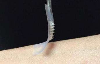 Revolutionary New Insulin Patch Could Change The Lives Of Diabetics Forever