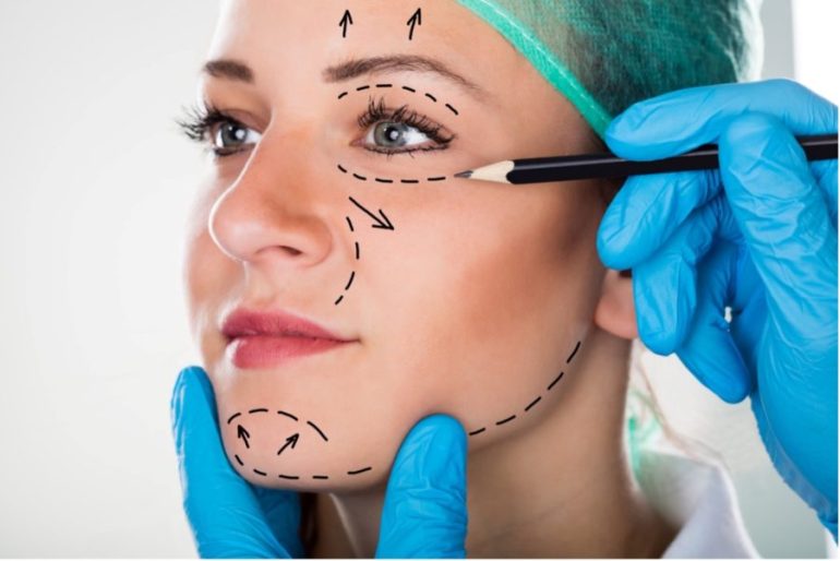 facelift cost