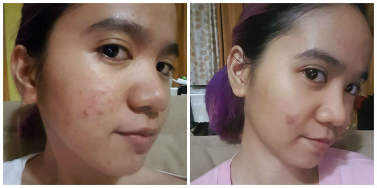 mosbeau collagen plus 12000 review - results